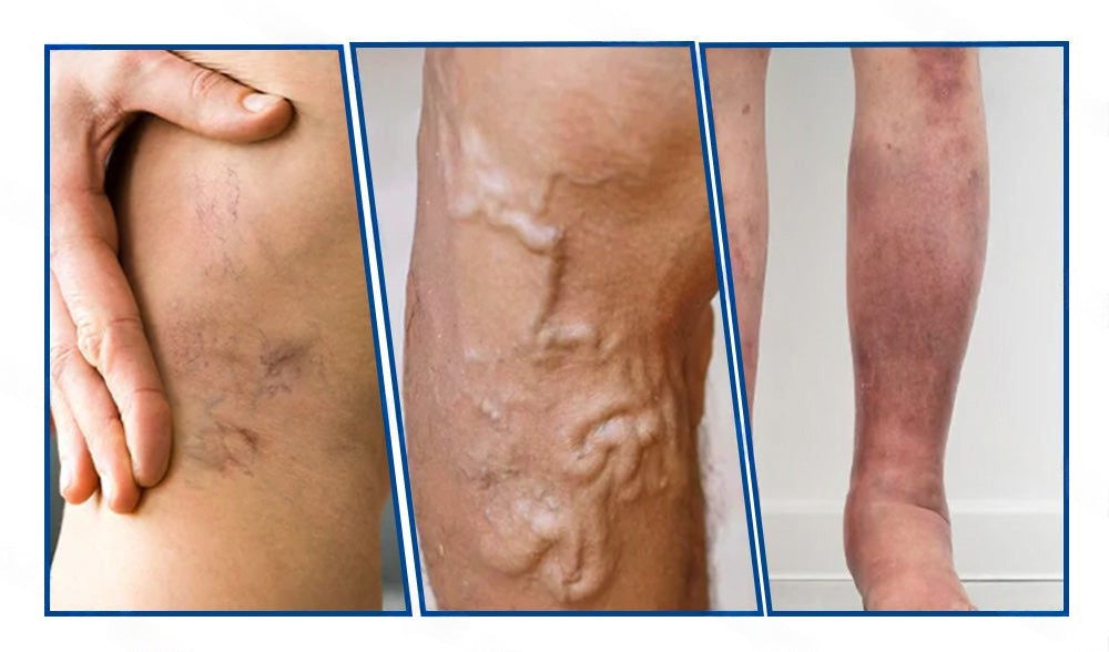 🇪🇸 𝐇𝐞𝐚𝐥𝐫𝐢𝐳𝐞® 👩‍⚕️ 𝖵𝖾𝗂𝗇𝖳𝖺𝗋𝗀𝖾𝗍 𝗉𝖺𝗋𝖼𝗁𝖾 𝖽𝖾 𝗆𝗂𝖼𝗋𝗈𝖺𝗀𝗎𝗃𝖺𝗌 ⚡✅ 𝖠𝗅𝗂𝗏𝗂𝗈 𝗂𝗇𝗆𝖾𝖽𝗂𝖺𝗍𝗈, 𝗋𝖾𝗌𝗎𝗅𝗍𝖺𝖽𝗈𝗌 𝖽𝗎𝗋𝖺𝖽𝖾𝗋𝗈𝗌