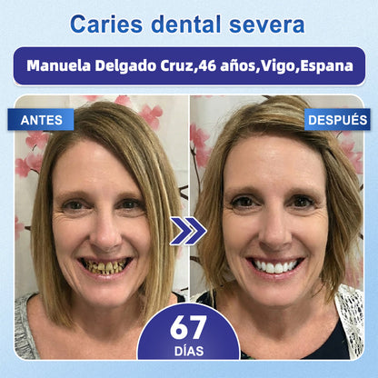 GаrаgеLіnе® 🦷 Tiras Orales de Reparación Rápida de Dientes y Encías con Tideglusib 😁 (Ayuda a reparar los dientes y alivia las molestias en las encías, además de apoyar la salud bucal frente a otros problemas comunes)