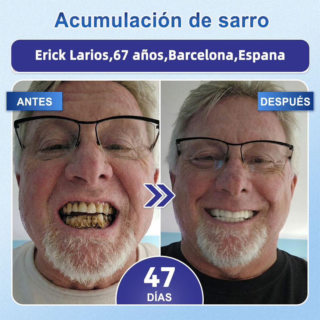 GаrаgеLіnе® 🦷 Tiras Orales de Reparación Rápida de Dientes y Encías con Tideglusib 😁 (Ayuda a reparar los dientes y alivia las molestias en las encías, además de apoyar la salud bucal frente a otros problemas comunes)