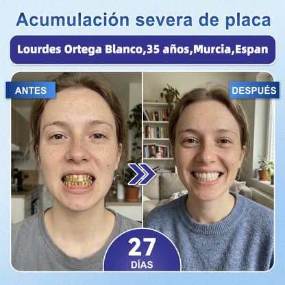 GаrаgеLіnе® 🦷 Tiras Orales de Reparación Rápida de Dientes y Encías con Tideglusib 😁 (Ayuda a reparar los dientes y alivia las molestias en las encías, además de apoyar la salud bucal frente a otros problemas comunes)