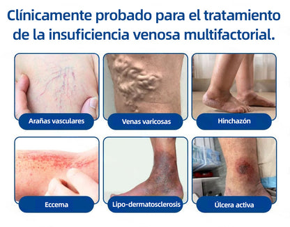🇪🇸 𝐇𝐞𝐚𝐥𝐫𝐢𝐳𝐞® ✅ 𝖵𝖾𝗂𝗇𝖳𝖺𝗋𝗀𝖾𝗍 𝗉𝖺𝗋𝖼𝗁𝖾 𝖽𝖾 𝗆𝗂𝖼𝗋𝗈𝖺𝗀𝗎𝗃𝖺𝗌 ⚡👩‍⚕️ 𝖠𝗅𝗂𝗏𝗂𝗈 𝗂𝗇𝗆𝖾𝖽𝗂𝖺𝗍𝗈, 𝗋𝖾𝗌𝗎𝗅𝗍𝖺𝖽𝗈𝗌 𝖽𝗎𝗋𝖺𝖽𝖾𝗋𝗈𝗌