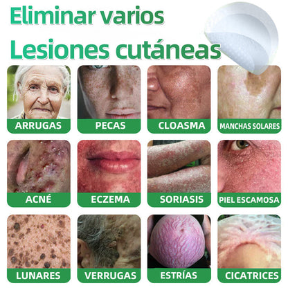 🇪🇸 Hudros® 😮‍💨 Parche 2 en 1 Microneedle Botanic 🧪| Eliminador de Lunares Elevados, Acné, Verrugas Planas y Pápulas de la Piel | Mejora Arrugas, Cicatrices y Manchas | Parches Invisibles para Espinillas en Cara y Cuerpo | 144 Unidades✨