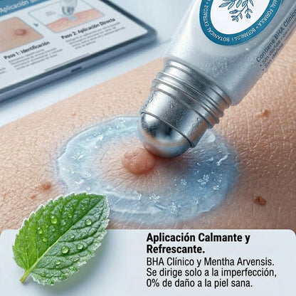 𝑻𝒓𝒊𝒍𝒖𝒎𝒊𝒂® 👨🏻‍⚕️ Bolígrafo Roller Premium | Eliminador de Verrugas, Lunares y Manchas 🇪🇸