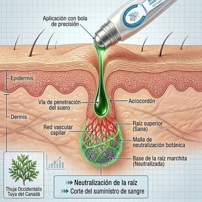 𝑻𝒓𝒊𝒍𝒖𝒎𝒊𝒂® 👨🏻‍⚕️ Bolígrafo Roller Premium | Eliminador de Verrugas, Lunares y Manchas 🇪🇸