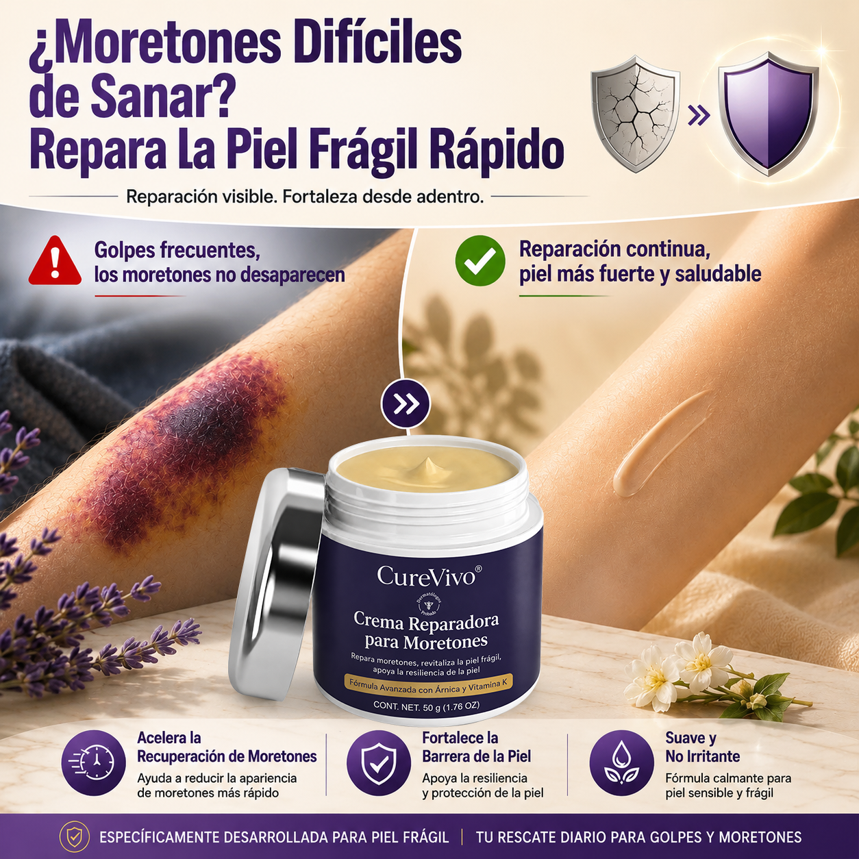 🔥🎫+100K Vendidos 💗 - CureVivo® Crema Reparadora de Moratones y Fortalecimiento de la Piel🇪🇸