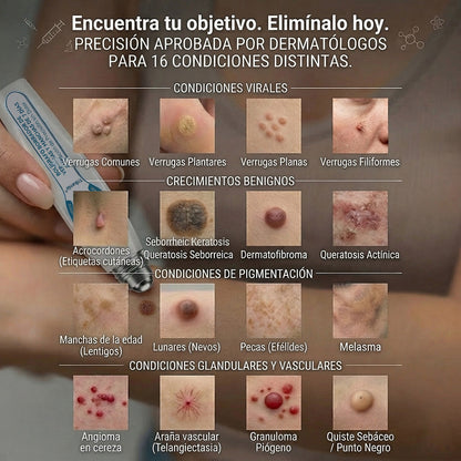 𝑻𝒓𝒊𝒍𝒖𝒎𝒊𝒂® 👨🏻‍⚕️ Bolígrafo Roller Premium | Eliminador de Verrugas, Lunares y Manchas 🇪🇸