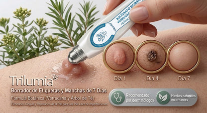 𝑻𝒓𝒊𝒍𝒖𝒎𝒊𝒂® 👨🏻‍⚕️ Bolígrafo Roller Premium | Eliminador de Verrugas, Lunares y Manchas 🇪🇸