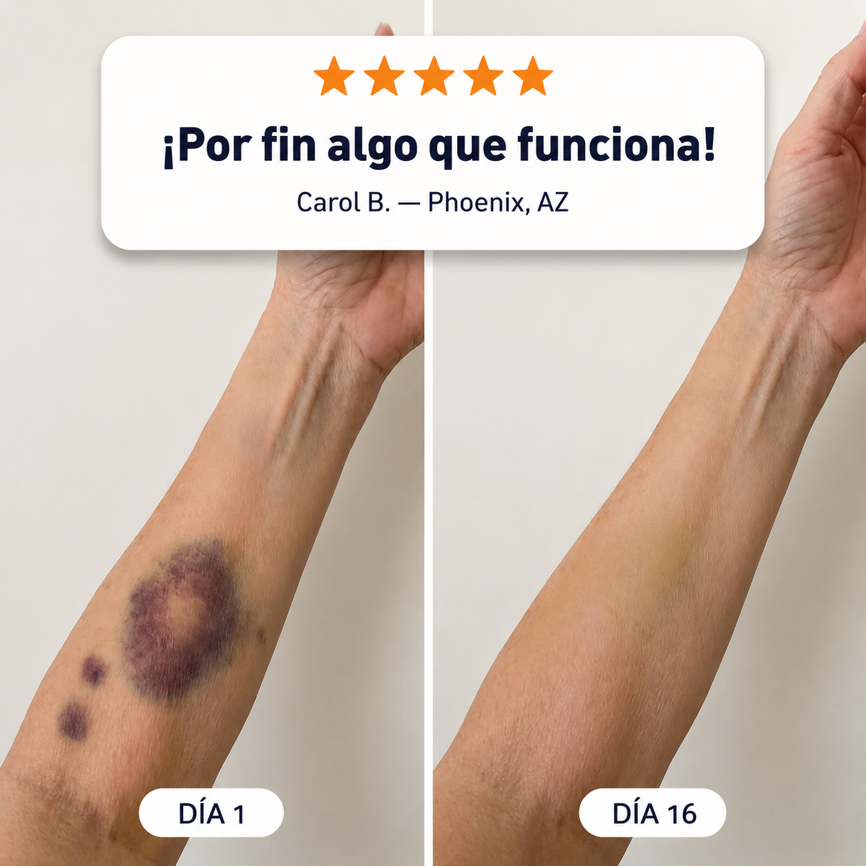 🔥🎫+100K Vendidos 💗 - CureVivo® Crema Reparadora de Moratones y Fortalecimiento de la Piel🇪🇸
