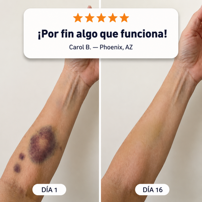 🔥🎫+100K Vendidos 💗 - CureVivo® Crema Reparadora de Moratones y Fortalecimiento de la Piel🇪🇸