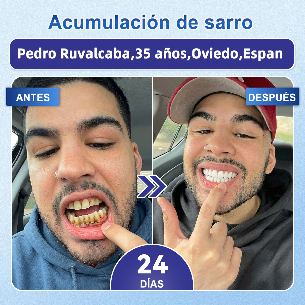 GаrаgеLіnе® 🦷 Tiras Orales de Reparación Rápida de Dientes y Encías con Tideglusib 😁 (Ayuda a reparar los dientes y alivia las molestias en las encías, además de apoyar la salud bucal frente a otros problemas comunes)