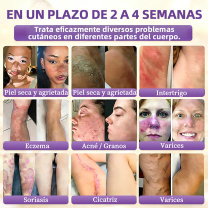 🇪🇸 Hecho y enviado desde España ✨CureVivo® Crema Restauradora de la Piel con Biotina 10-en-1 👑👑👑
