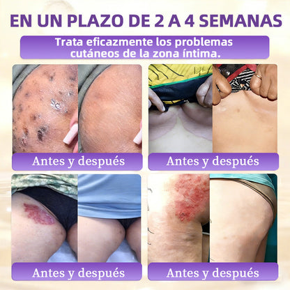 🇪🇸 Hecho y enviado desde España ✨CureVivo® Crema Restauradora de la Piel con Biotina 10-en-1 👑👑👑
