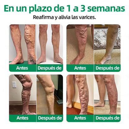 🏆🏆🏆Parche de Microagujas Healrize® VeinTarget —— Alivio Instantáneo, Resultados a Largo Plazo