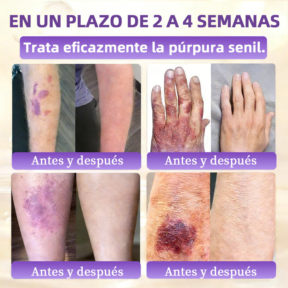 🇪🇸 Hecho y enviado desde España ✨CureVivo® Crema Restauradora de la Piel con Biotina 10-en-1 👑👑👑