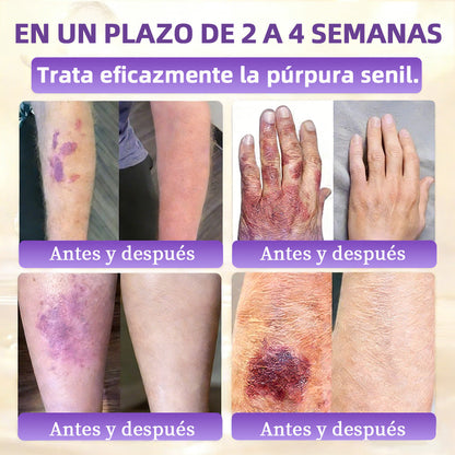 🇪🇸 Hecho y enviado desde España ✨CureVivo® Crema Restauradora de la Piel con Biotina 10-en-1 👑👑👑