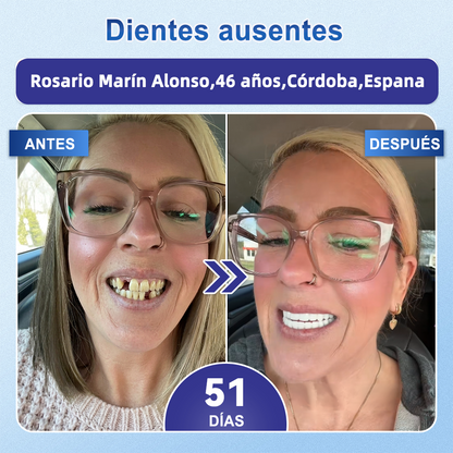 GаrаgеLіnе® 🦷 Tiras Orales de Reparación Rápida de Dientes y Encías con Tideglusib 😁 (Ayuda a reparar los dientes y alivia las molestias en las encías, además de apoyar la salud bucal frente a otros problemas comunes)