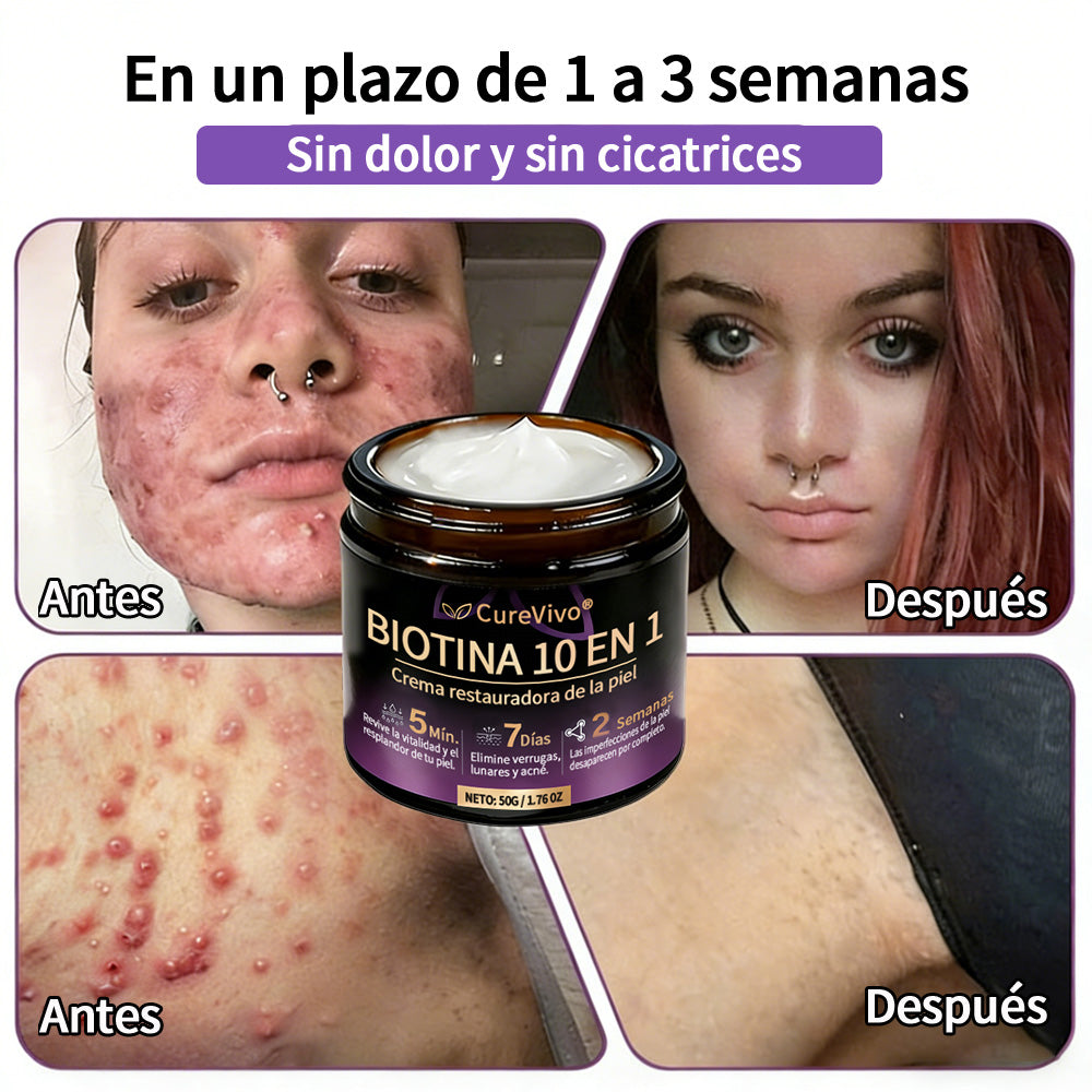 🇪🇸 Hecho y enviado desde España ✨CureVivo® Crema Restauradora de la Piel con Biotina 10-en-1 👑👑👑