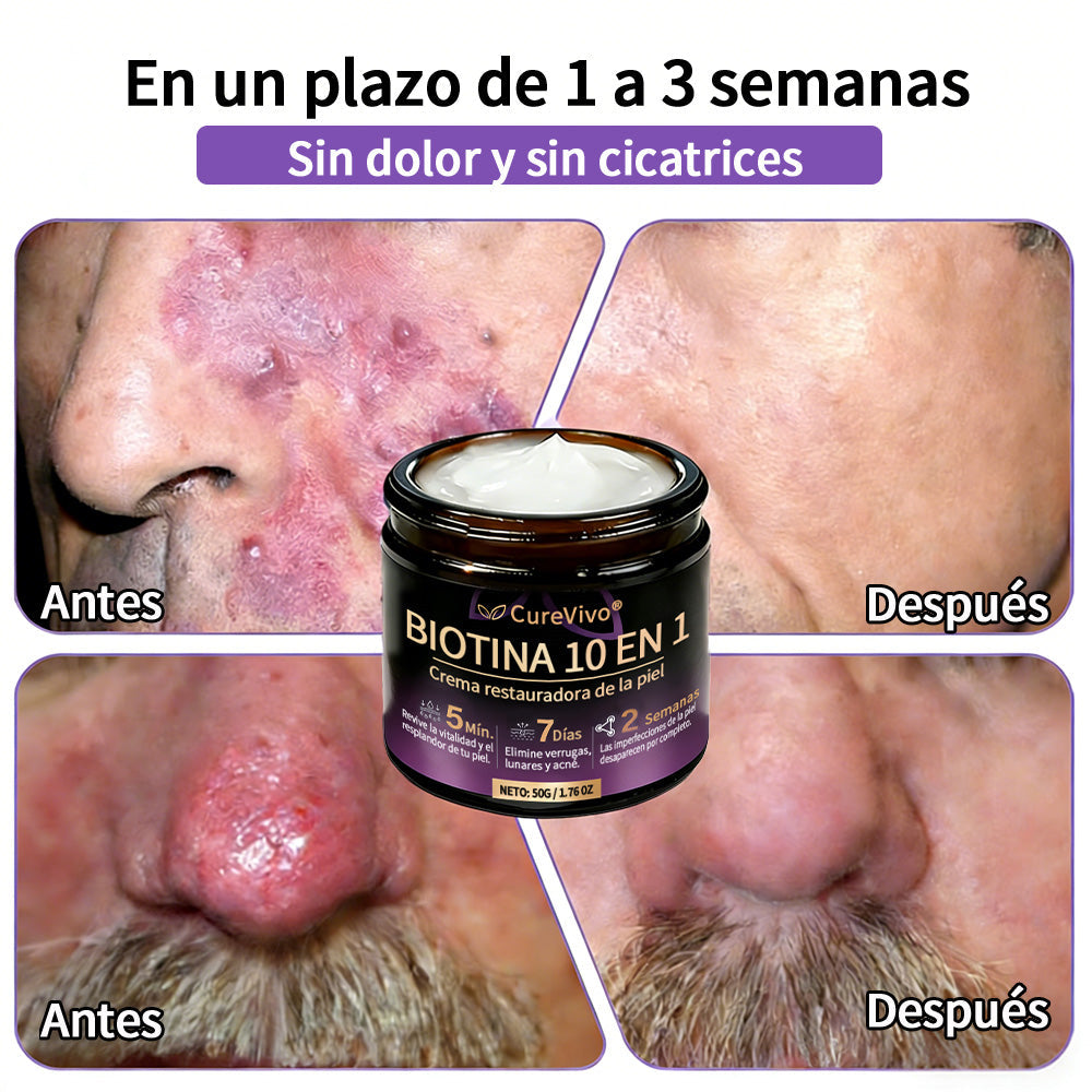 🇪🇸 Hecho y enviado desde España ✨CureVivo® Crema Restauradora de la Piel con Biotina 10-en-1 👑👑👑