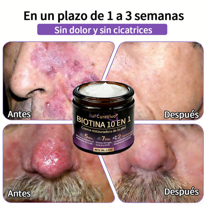 🇪🇸 Hecho y enviado desde España ✨CureVivo® Crema Restauradora de la Piel con Biotina 10-en-1 👑👑👑
