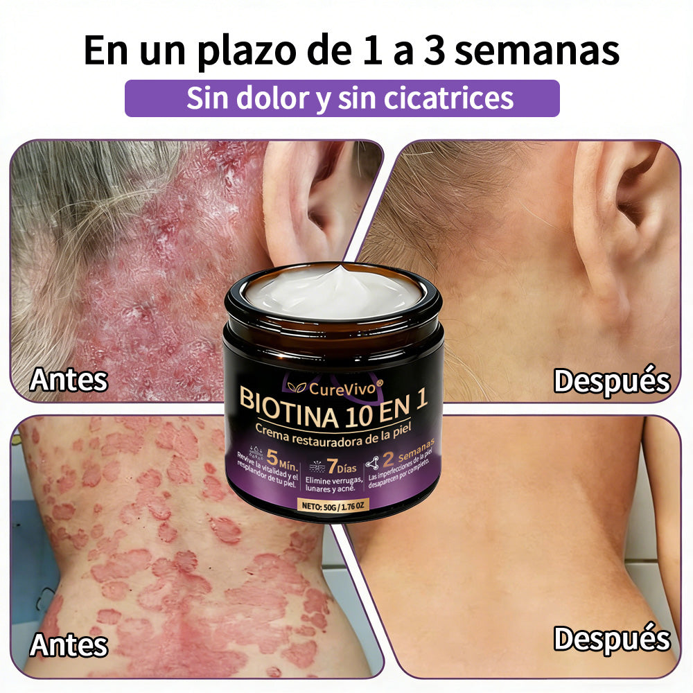 🇪🇸 Hecho y enviado desde España ✨CureVivo® Crema Restauradora de la Piel con Biotina 10-en-1 👑👑👑