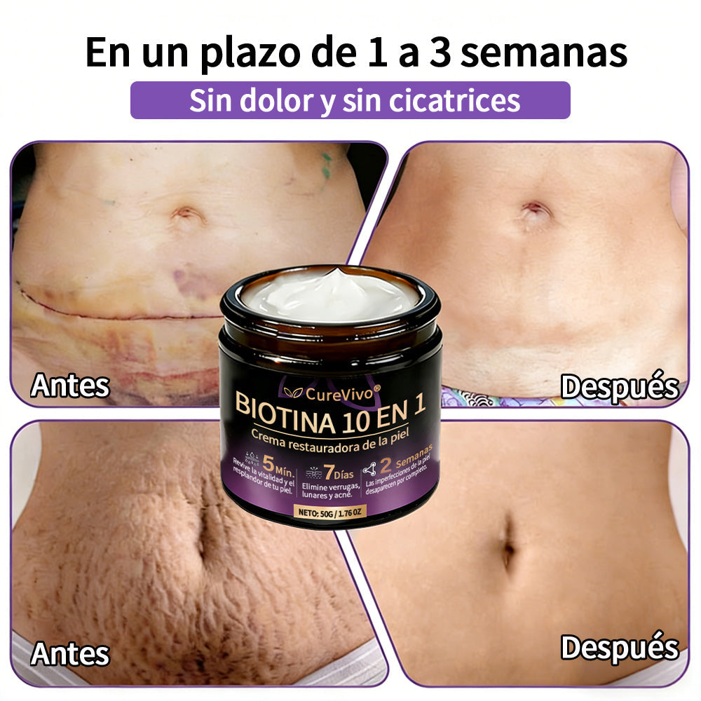 🇪🇸 Hecho y enviado desde España ✨CureVivo® Crema Restauradora de la Piel con Biotina 10-en-1 👑👑👑