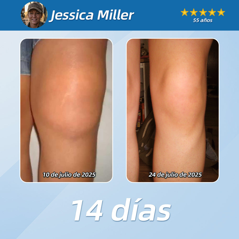 𝐋𝐨𝐜𝐢ó𝐧 𝐫𝐞𝐩𝐚𝐫𝐚𝐝𝐨𝐫𝐚 𝐜𝐚𝐥𝐦𝐚𝐧𝐭𝐞 𝐂𝐮𝐫𝐞𝐕𝐢𝐯𝐨® 👩‍⚕️ 𝐀𝐥𝐢𝐯𝐢𝐚 𝐞𝐥 𝐝𝐨𝐥𝐨𝐫 𝐦𝐮𝐬𝐜𝐮𝐥𝐚𝐫, 𝐚𝐫𝐭𝐢𝐜𝐮𝐥𝐚𝐫 𝐲 𝐧𝐞𝐫𝐯𝐢𝐨𝐬𝐨 🌞🌞