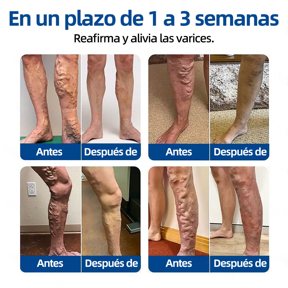 🇪🇸 𝐇𝐞𝐚𝐥𝐫𝐢𝐳𝐞® 👩‍⚕️ 𝖵𝖾𝗂𝗇𝖳𝖺𝗋𝗀𝖾𝗍 𝗉𝖺𝗋𝖼𝗁𝖾 𝖽𝖾 𝗆𝗂𝖼𝗋𝗈𝖺𝗀𝗎𝗃𝖺𝗌 ⚡✅ 𝖠𝗅𝗂𝗏𝗂𝗈 𝗂𝗇𝗆𝖾𝖽𝗂𝖺𝗍𝗈, 𝗋𝖾𝗌𝗎𝗅𝗍𝖺𝖽𝗈𝗌 𝖽𝗎𝗋𝖺𝖽𝖾𝗋𝗈𝗌