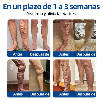 🇪🇸 𝐇𝐞𝐚𝐥𝐫𝐢𝐳𝐞® ✅ 𝖵𝖾𝗂𝗇𝖳𝖺𝗋𝗀𝖾𝗍 𝗉𝖺𝗋𝖼𝗁𝖾 𝖽𝖾 𝗆𝗂𝖼𝗋𝗈𝖺𝗀𝗎𝗃𝖺𝗌 ⚡👩‍⚕️ 𝖠𝗅𝗂𝗏𝗂𝗈 𝗂𝗇𝗆𝖾𝖽𝗂𝖺𝗍𝗈, 𝗋𝖾𝗌𝗎𝗅𝗍𝖺𝖽𝗈𝗌 𝖽𝗎𝗋𝖺𝖽𝖾𝗋𝗈𝗌
