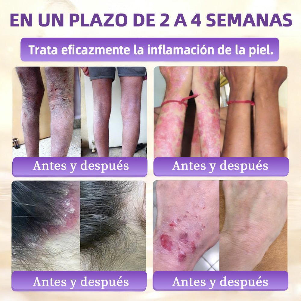 🇪🇸 Hecho y enviado desde España ✨CureVivo® Crema Restauradora de la Piel con Biotina 10-en-1 👑👑👑