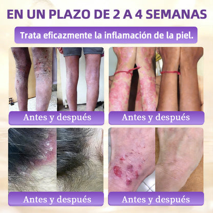 🇪🇸 Hecho y enviado desde España ✨CureVivo® Crema Restauradora de la Piel con Biotina 10-en-1 👑👑👑