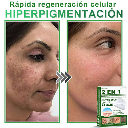 🇪🇸 Hudros® 😮‍💨 Parche 2 en 1 Microneedle Botanic 🧪| Eliminador de Lunares Elevados, Acné, Verrugas Planas y Pápulas de la Piel | Mejora Arrugas, Cicatrices y Manchas | Parches Invisibles para Espinillas en Cara y Cuerpo | 144 Unidades✨