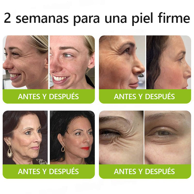 💡 𝑪𝒓𝒆𝒂𝒘𝒆𝒍® 𝑩𝒐𝒕𝒐𝒙 & 𝑽𝒊𝒕𝒂-𝑨 𝑹𝒆𝒕𝒊𝒏𝒐𝒍 𝑺𝒉𝒐𝒕 𝒄𝒓𝒆𝒎𝒂 𝒓𝒆𝒂𝒇𝒊𝒓𝒎𝒂𝒏𝒕𝒆 𝒂𝒏𝒕𝒊𝒂𝒓𝒓𝒖𝒈𝒂𝒔 ⏰ ¡Ú𝒍𝒕𝒊𝒎𝒐 𝒅í𝒂! 70% 𝒅𝒆 𝒅𝒆𝒔𝒄𝒖𝒆𝒏𝒕𝒐 🧴🧴🧴