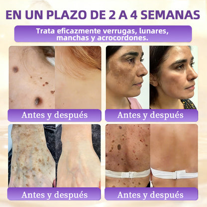 🇪🇸 Hecho y enviado desde España ✨CureVivo® Crema Restauradora de la Piel con Biotina 10-en-1 👑👑👑